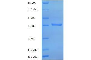 SDS-PAGE (SDS) image for Ribosomal Protein, Large, P0 (RPLP0) (AA 1-317), (full length) protein (His tag) (ABIN5713800)