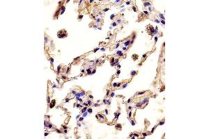 Antibody staining MMP12 in human lung tissue sections by Immunohistochemistry (IHC-P - paraformaldehyde-fixed, paraffin-embedded sections).