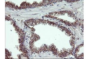 Image no. 4 for anti-Retinaldehyde Binding Protein 1 (RLBP1) antibody (ABIN1497622) (RLBP1 anticorps)