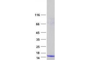 Validation with Western Blot