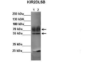 Sample Type: Lane 1: FALG IP'd FLAG-KIR2DL4 transfected NK92 cells Lane 2: FALG IP'd FLAG-KIR2DL5 transfected NK92 cells Primary Antibody Dilution: 1:500Secondary Antibody: Anti-rabbit-HRP Secondary Antibody Dilution: 1:00,000 Color/Signal Descriptions: KIR2DL5B  Gene Name: Kerry S. (KIR2DL5B anticorps  (C-Term))