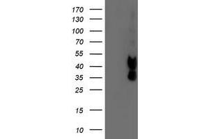 Western Blotting (WB) image for anti-Prenyl (Decaprenyl) Diphosphate Synthase, Subunit 2 (PDSS2) antibody (ABIN1500141) (PDSS2 anticorps)