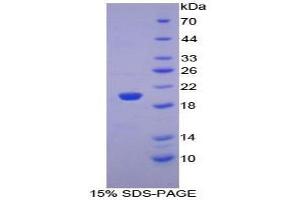 SDS-PAGE analysis of Mouse PHLDA2 Protein. (PHLDA2 Protéine)