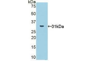 Detection of Recombinant NOX1, Human using Polyclonal Antibody to Nicotinamide Adenine Dinucleotide Phosphate Oxidase 1 (NOX1) (NOX1 anticorps  (AA 235-488))