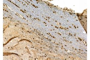 ABIN6263548 and ABIN6277572 at 1/100 staining Rat brain tissue by IHC-P.