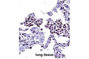 Immunohistochemistry (IHC) image for anti-Toll-Like Receptor 8 (TLR8) antibody (ABIN2997670) (TLR8 anticorps)