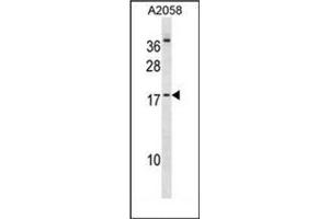 Western blot analysis of HEN2 Antibody (Center) in A2058 cell line lysates (35ug/lane). (NHLH2 anticorps  (Middle Region))
