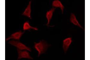 anti-BMX Non-Receptor Tyrosine Kinase (BMX) (pTyr566) antibody