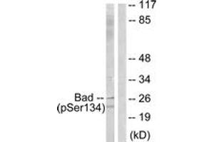 Western blot analysis of extracts from mouse liver, using BAD (Phospho-Ser134) Antibody. (BAD anticorps  (pSer134))