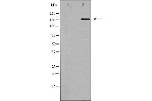 Western blot analysis of DNA Polymerase α expression in 293 cells,The lane on the left is treated with the antigen-specific peptide.