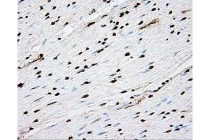 Immunohistochemical staining of paraffin-embedded liver tissue using anti-ACSBG1 mouse monoclonal antibody. (ACSBG1 anticorps)