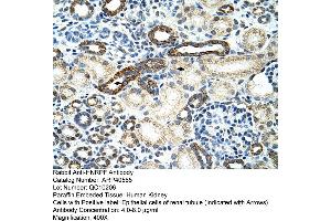 Rabbit Anti-HNRPF Antibody  Paraffin Embedded Tissue: Human Kidney Cellular Data: Epithelial cells of renal tubule Antibody Concentration: 4. (HNRNPF anticorps  (C-Term))
