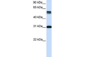 WB Suggested Anti-TRIM31 Antibody Titration: 0. (TRIM31 anticorps  (Middle Region))