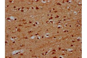 IHC image of ABIN7164105 diluted at 1:600 and staining in paraffin-embedded human brain tissue performed on a Leica BondTM system. (PRDM11 anticorps  (AA 63-215))