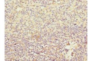 Immunohistochemistry of paraffin-embedded human spleen tissue using ABIN7156851 at dilution of 1:100 (IL21 Receptor anticorps  (AA 20-240))