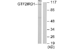 Western blot analysis of extracts from 293 cells, using GTF2IRD1 antibody. (GTF2IRD1 anticorps)