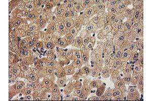 Image no. 3 for anti-Acyl-CoA Thioesterase 12 (ACOT12) antibody (ABIN1496415)