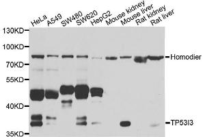 Western blot analysis of extracts of various cell lines, using TP53I3 antibody (ABIN5974745) at 1/1000 dilution.