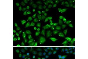 Immunofluorescence analysis of HeLa cells using NHLRC1 Polyclonal Antibody (NHLRC1 anticorps)