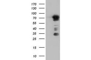 Western Blotting (WB) image for anti-rho GTPase Activating Protein 25 (ARHGAP25) antibody (ABIN1496705) (ARHGAP25 anticorps)