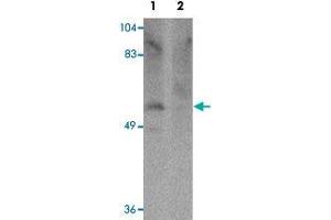 Western blot analysis of human brain tissue with PPAPDC1A polyclonal antibody  at 1 ug/mL in (Lane 1) the absence and (Lane 2) the presence of blocking peptide. (PPAPDC1A anticorps  (C-Term))