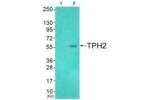 Western blot analysis of extracts from HuvEc cells (Lane 2), using TPH2 (Ab-19) antiobdy. (Tryptophan Hydroxylase 2 anticorps  (Ser19))