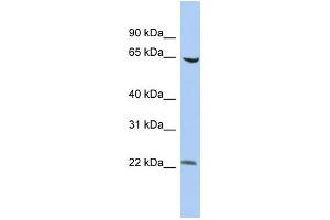 WB Suggested Anti-SCMH1 Antibody Titration:  0. (SCMH1 anticorps  (Middle Region))