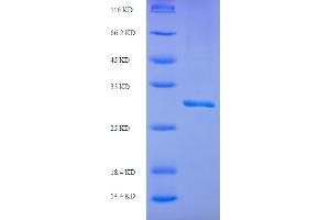 SDS-PAGE (SDS) image for Inter alpha Globulin Inhibitor H5 (ITIH5) (AA 35-161) protein (His-SUMO Tag) (ABIN5711467)