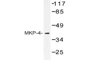 Western blot (WB) analysis of MKP-4 antibody in extracts from HeLa cells.