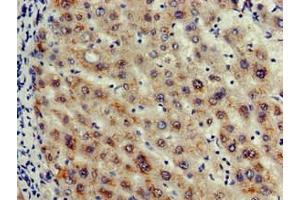 Immunohistochemistry of paraffin-embedded human liver tissue using ABIN7156146 at dilution of 1:100