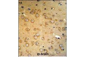 VHL Antibody (C-term) (R) IHC analysis in formalin fixed and paraffin embedded mouse brain tissue followed by peroxidase conjugation of the secondary antibody and DAB staining.