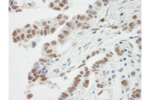 Immunohistochemistry (IHC) image for anti-SWI/SNF Related, Matrix Associated, Actin Dependent Regulator of Chromatin, Subfamily E, Member 1 (SMARCE1) (C-Term) antibody (ABIN7448428)