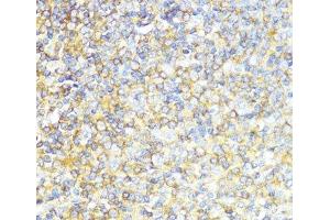Immunohistochemistry of paraffin-embedded Human tonsil using MLKL Polyclonal Antibody at dilution of 1:200 (40x lens). (MLKL anticorps)