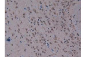 Detection of CPB2 in Mouse Brain Tissue using Polyclonal Antibody to Carboxypeptidase B2 (CPB2)