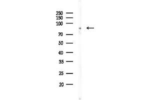 anti-Zinc Finger and BTB Domain Containing 17 (ZBTB17) (Internal Region) antibody