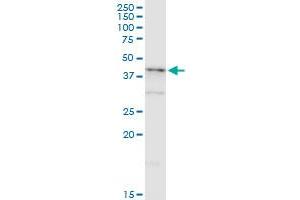 NDRG2 monoclonal antibody (M03), clone 6A5. (NDRG2 anticorps  (AA 1-96))