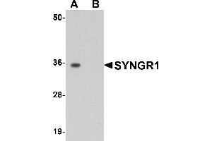 Western Blotting (WB) image for anti-Synaptogyrin 1 (SYNGR1) (Middle Region) antibody (ABIN1031113) (Synaptogyrin 1 anticorps  (Middle Region))