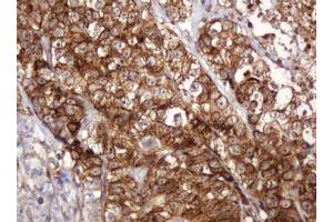 Image no. 8 for anti-B and T Lymphocyte Associated (BTLA) antibody (ABIN1496983) (BTLA anticorps)