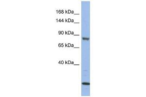 MAP3K11 antibody used at 1 ug/ml to detect target protein.