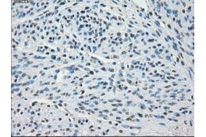 Image no. 2 for anti-Synovial Sarcoma, X Breakpoint 2 (SSX2) antibody (ABIN1501162) (SSX2 anticorps)