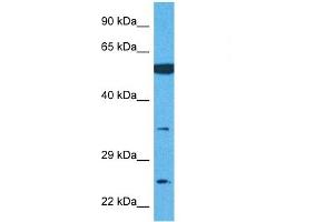 Host:  Rabbit  Target Name:  TMEM158  Sample Tissue:  Human U937 Whole Cell  Antibody Dilution:  1ug/ml (TMEM158 anticorps  (Middle Region))