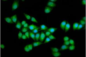 Immunofluorescence staining of Hela cells with ABIN7151576 at 1:166, counter-stained with DAPI. (ELP2 anticorps  (AA 323-457))