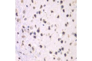 Immunohistochemistry of paraffin-embedded mouse brain using PRMT5 antibody (ABIN5970714) at dilution of 1/100 (40x lens). (PRMT5 anticorps)
