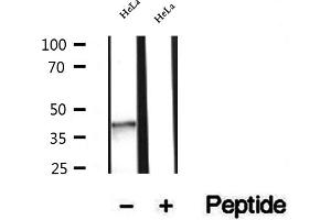 Western blot analysis of extracts of HeLa cells, using NSDHL antibody. (NSDHL anticorps  (Internal Region))