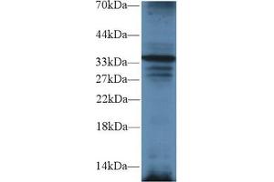 Western Blot; Sample: Mouse Liver lysate; Primary Ab: 2µg/ml Rabbit Anti-Mouse TRADD Antibody Second Ab: 0. (TRADD anticorps  (AA 21-259))