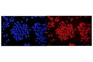 IF analysis of WAC using anti-WAC antibody (ABIN7601789). (WAC anticorps  (AA 459-647))
