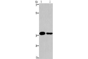 Western Blotting (WB) image for anti-SNAIL (SNAI1) antibody (ABIN2428726) (SNAIL anticorps)