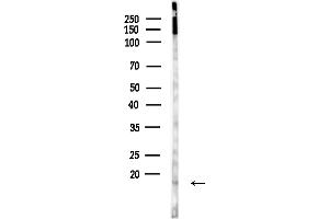 Western blot analysis of lysates from Hela cells(heat-shock,45 min treatment), using POLR2I Antibody at 1/1000 dilution.