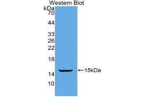 Detection of Recombinant POSTN, Mouse using Polyclonal Antibody to Periostin (POSTN)