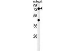 Western blot analysis in mouse heart tissue lysates (15ug/lane) using PHTF2 Antibody . (PHTF2 anticorps  (Middle Region))